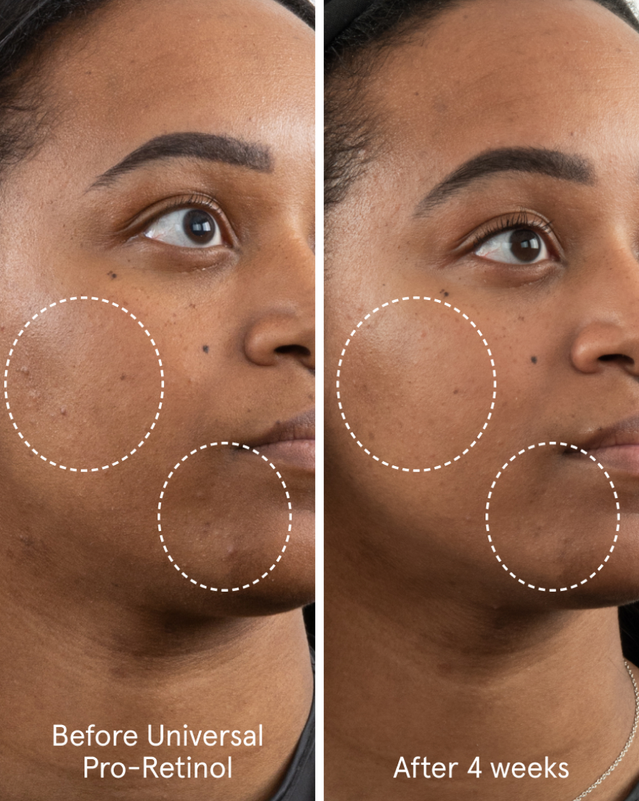 Universal Pro-Retinol